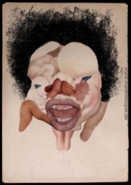 Eileiterschwangerschaft