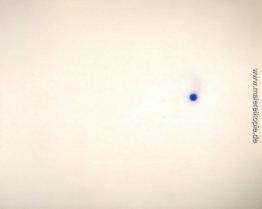 Blaue Stellen- Blaue Stellen-